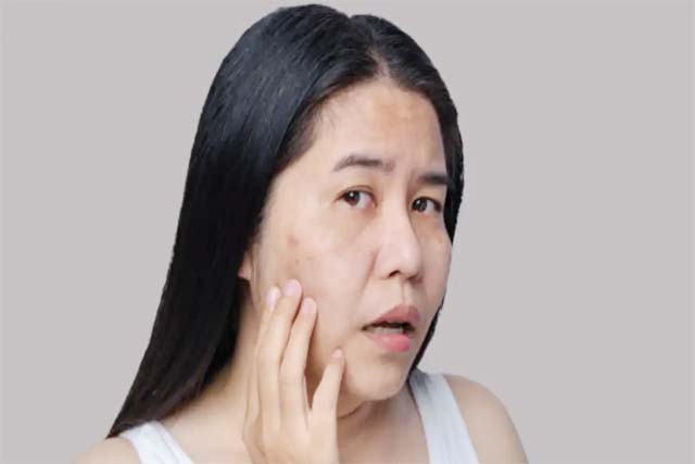 लिवर और प्लीहा में स्थित रंजक पित्त बढाता है चेहरे की रंगत, ताजगी