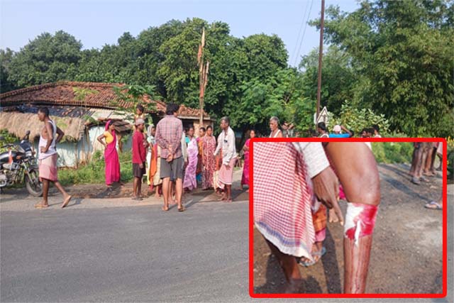 बाइक लूटने का विरोध करने पर व्यक्ति को मारी गोली, लोगों के जुटने पर भागे बदमाश